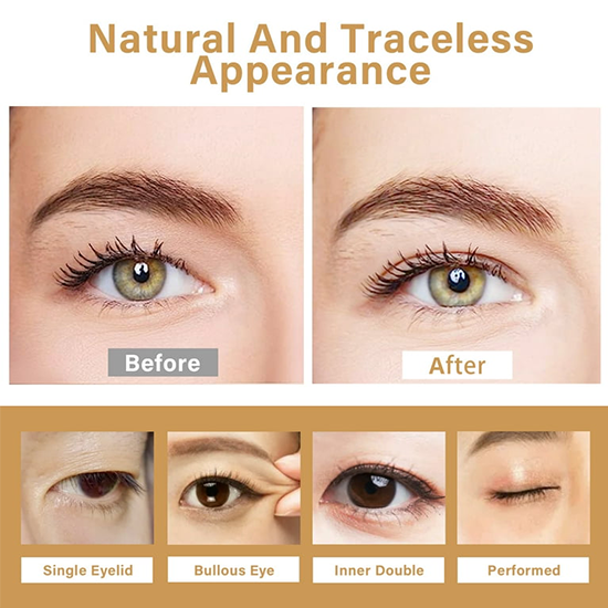 Eyelid Tape, 480 Pcs Eyelid Lifter Strips My Store